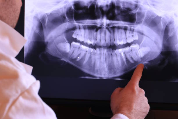 Best Emergency TMJ Treatment in Clover, SC
