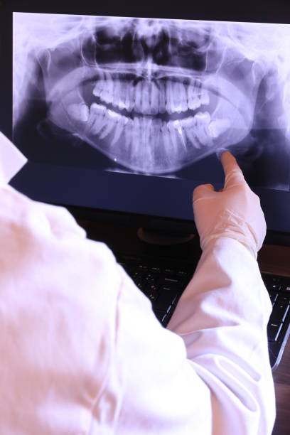 Best Emergency Root Canal Treatment in Clover, SC
