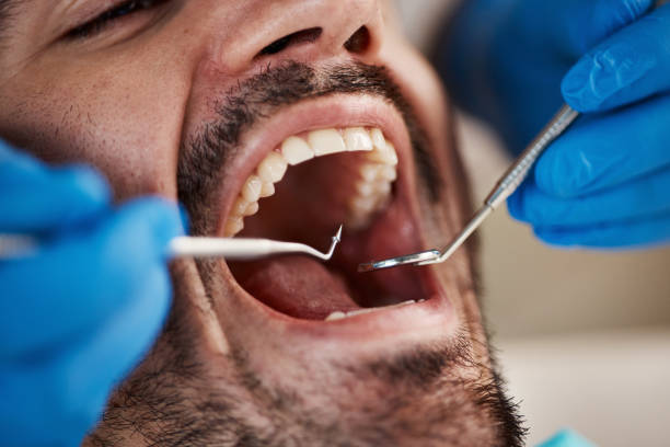Best Emergency Denture Repair in Clover, SC
